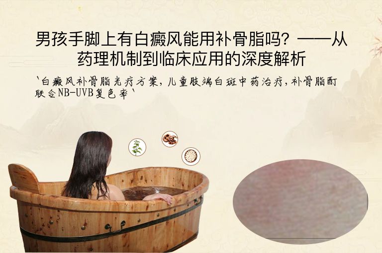 男孩手脚上有白癜风能用补骨脂吗?——从药理机制到临床应用的深度解析