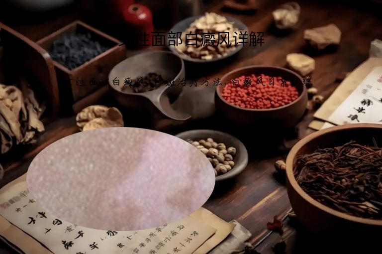 女性面部白癜风详解”