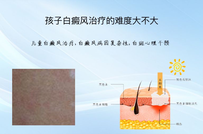 https://www.bdfsjzyy.com/d/file/p/8a53518b939ea399faa223303c5e7f98.jpeg
