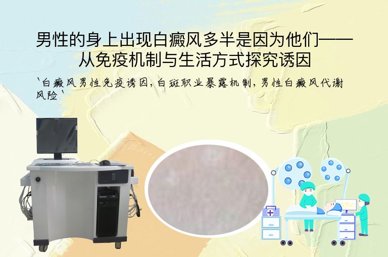 男性的身上出现白癜风多半是因为他们——从免疫机制与生活方式探究诱因