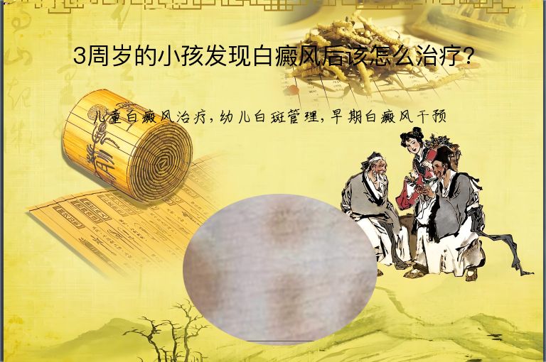 https://www.bdfsjzyy.com/d/file/p/99879b07dfb9f2624c80818390d42218.jpeg