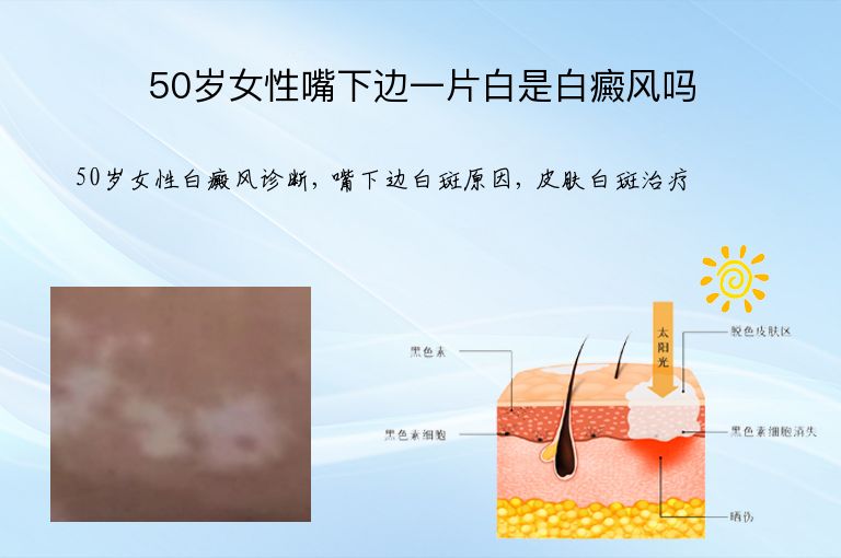 https://www.bdfsjzyy.com/d/file/p/27f6c6cce54cc98674d0dc2cd8f57052.jpeg