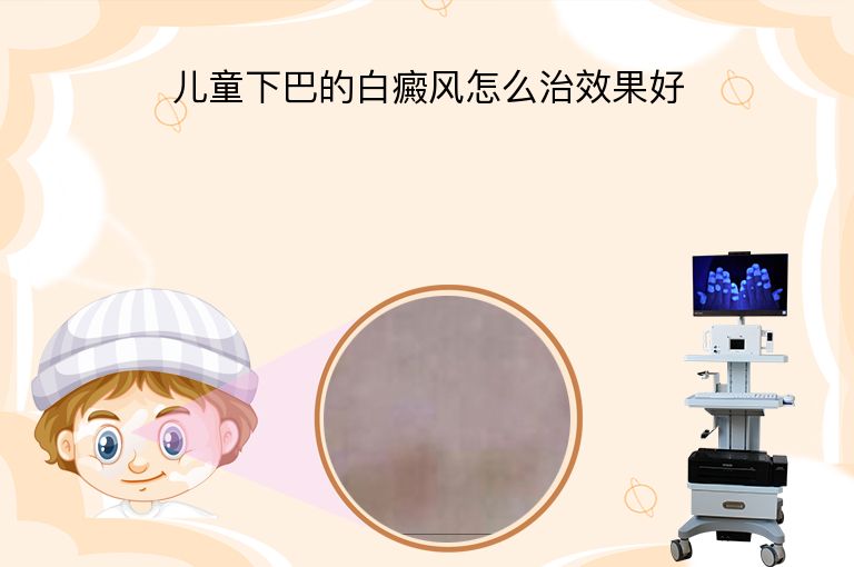 https://www.bdfsjzyy.com/d/file/p/8b268b97cfad7773ac11c63da8c92334.jpeg