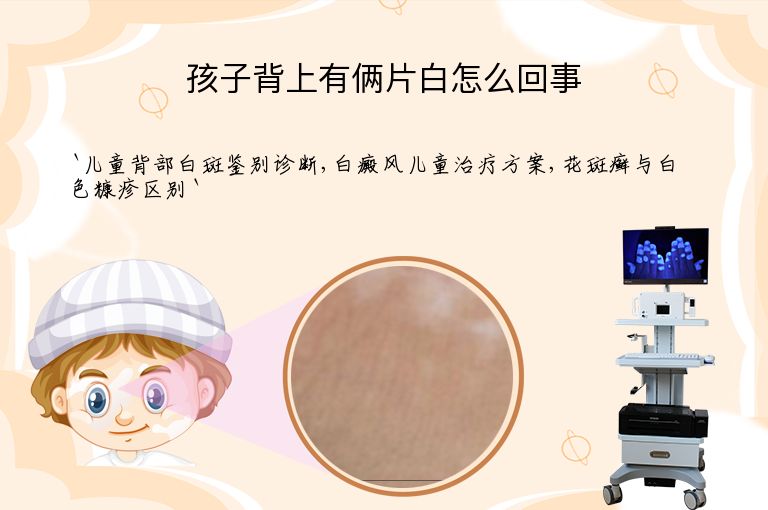 孩子背上有俩片白怎么回事