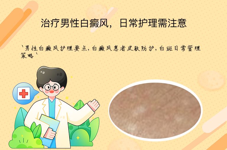治疗男性白癜风,日常护理需注意