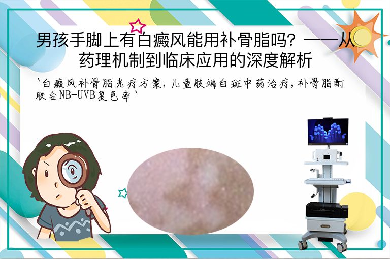 男孩手脚上有白癜风能用补骨脂吗？——从药理机制到临床应用的深度解析