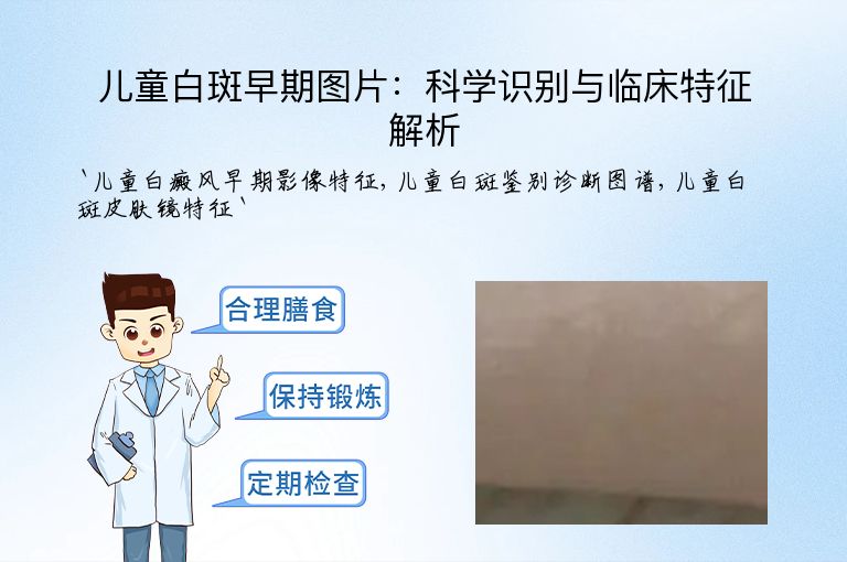 儿童白斑早期图片:科学识别与临床特征解析