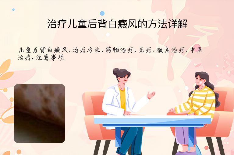 治疗儿童后背白癜风的方法详解”