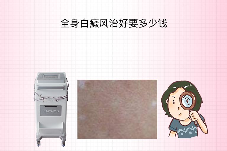 https://www.bdfsjzyy.com/d/file/p/54a3503c82667871fdaa93909bd355be.jpeg