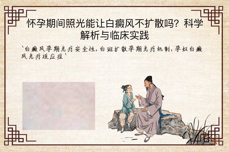 怀孕期间照光能让白癜风不扩散吗？科学解析与临床实践”