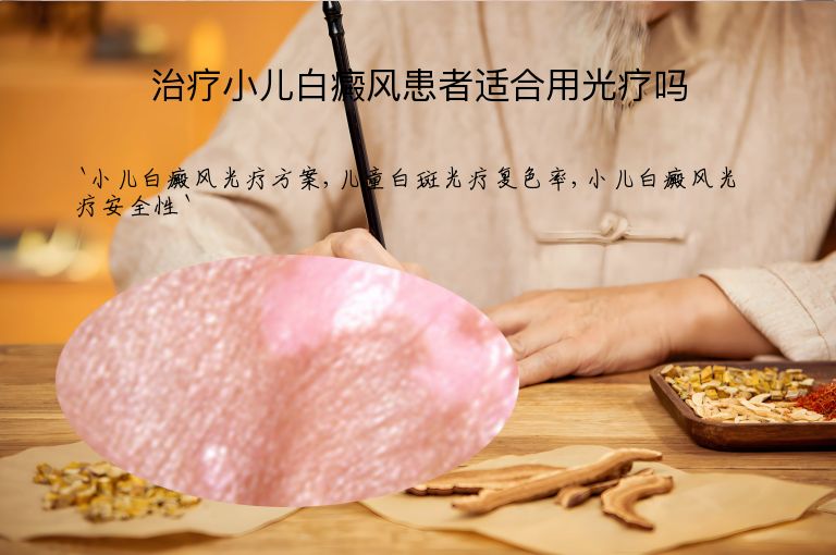 治疗小儿白癜风患者适合用光疗吗