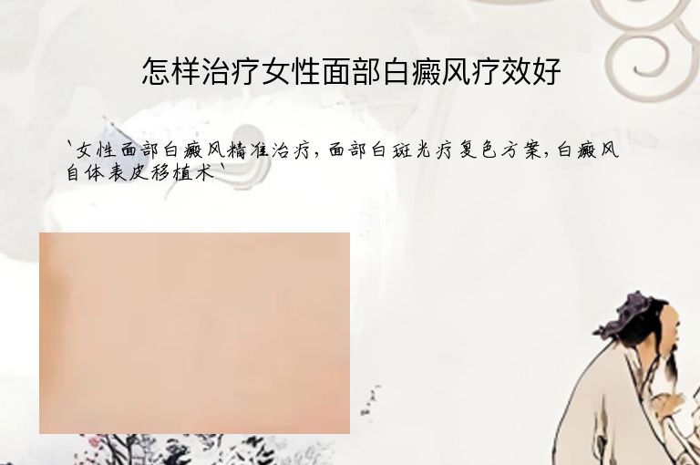 怎样治疗女性面部白癜风疗效好”