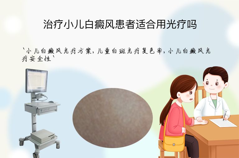 治疗小儿白癜风患者适合用光疗吗