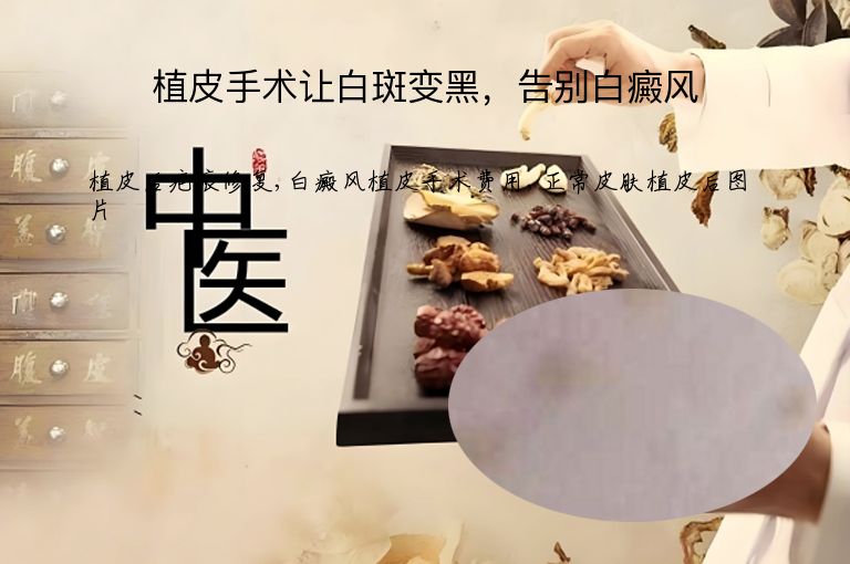 https://www.bdfsjzyy.com/d/file/p/60c7b6dbe5337390eaed145048d84546.jpeg