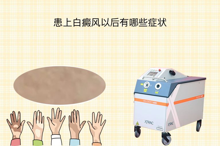 https://www.bdfsjzyy.com/d/file/p/36e00f0a9aa99b583f2a960dc57b4fc4.jpeg