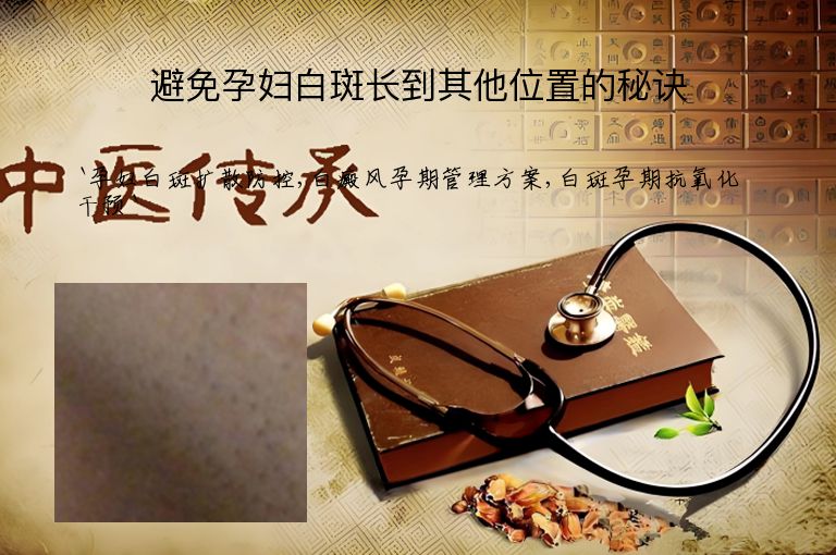 避免孕妇白斑长到其他位置的秘诀