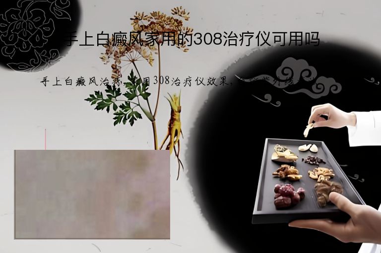 手上白癜风家用的308治疗仪可用吗”