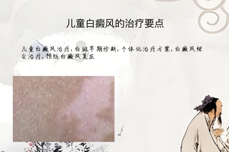 儿童白癜风的治疗要点”