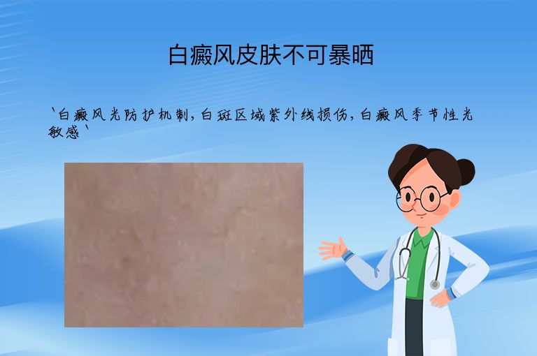白癜风皮肤不可暴晒
