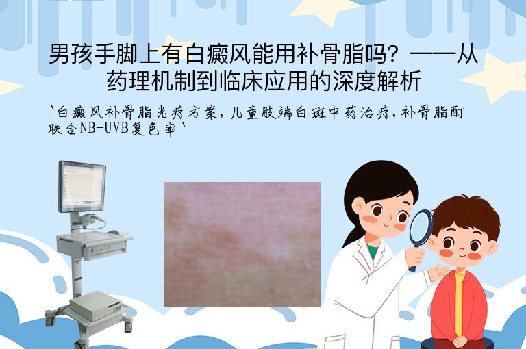 男孩手脚上有白癜风能用补骨脂吗?——从药理机制到临床应用的深度解析