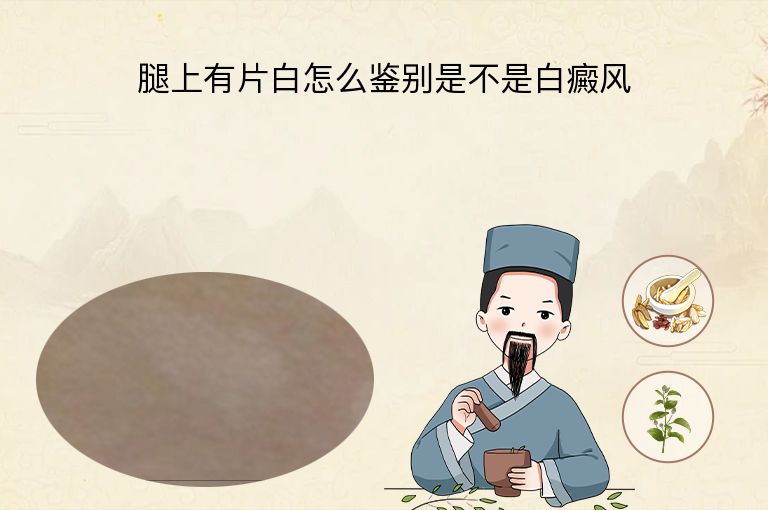 腿上有片白怎么鉴别是不是白癜风