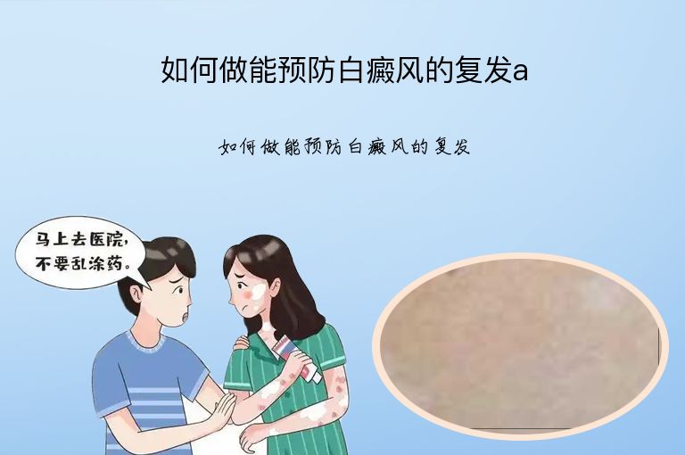 如何做能预防白癜风的复发a”