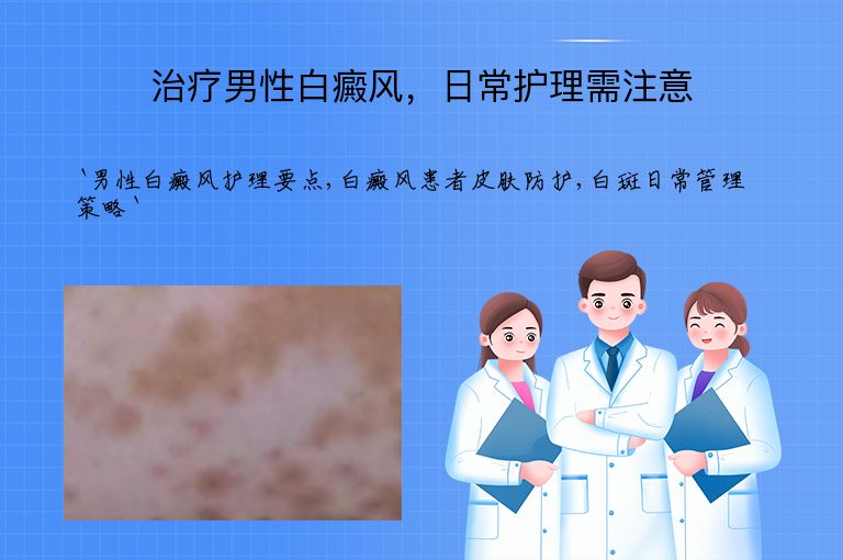 治疗男性白癜风,日常护理需注意