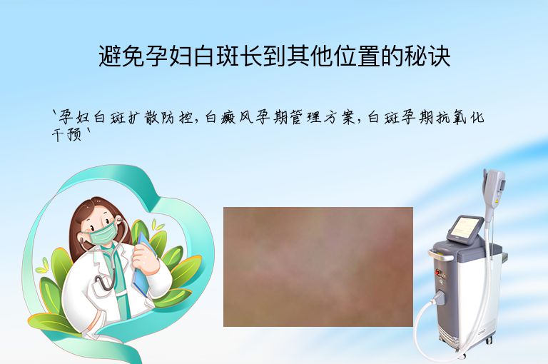 避免孕妇白斑长到其他位置的秘诀
