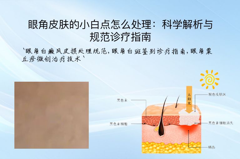 眼角皮肤的小白点怎么处理:科学解析与规范诊疗指南