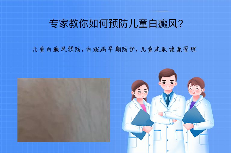 专家教你如何预防儿童白癜风?”