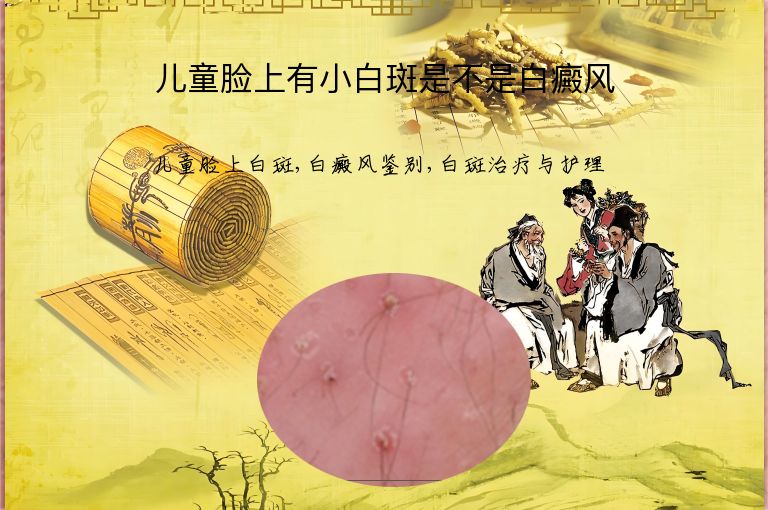 儿童脸上有小白斑是不是白癜风”