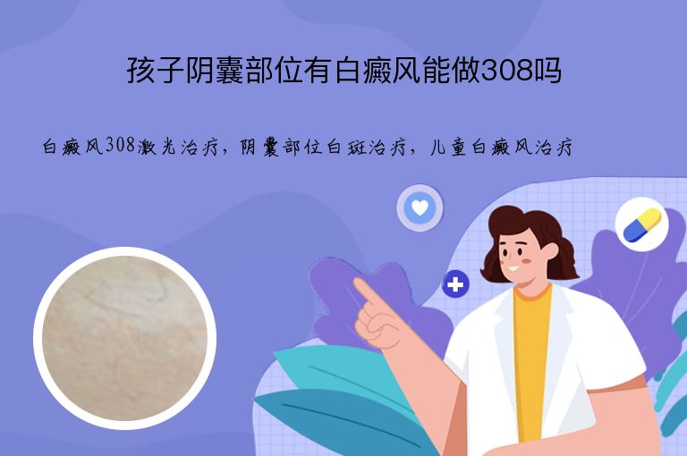 孩子阴囊部位有白癜风能做308吗”