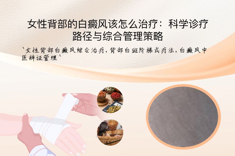 女性背部的白癜风该怎么治疗:科学诊疗路径与综合管理策略