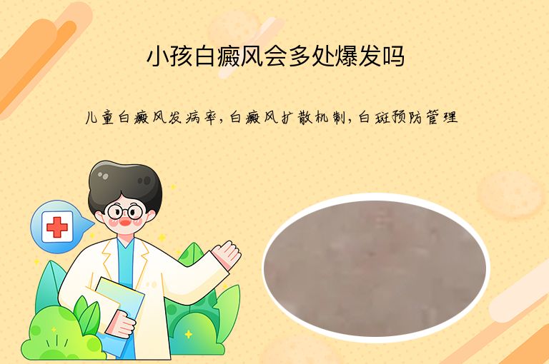 https://www.bdfsjzyy.com/d/file/p/54534a8c1162df7eb0122e2ad80d1a65.jpeg