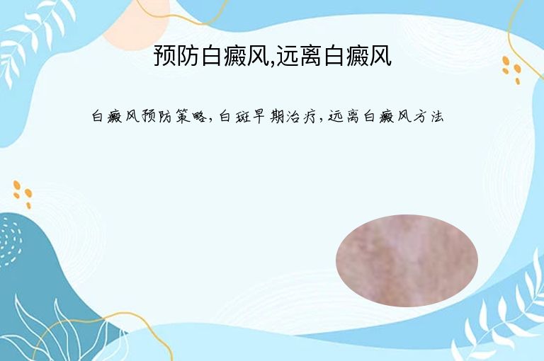 预防白癜风,远离白癜风”