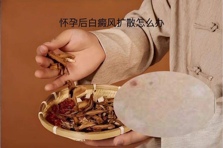 https://www.bdfsjzyy.com/d/file/p/7883ad5d0a578416cae1ba2b720416d8.jpeg