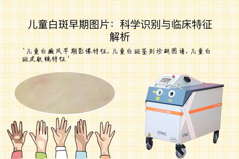 儿童白斑早期图片:科学识别与临床特征解析