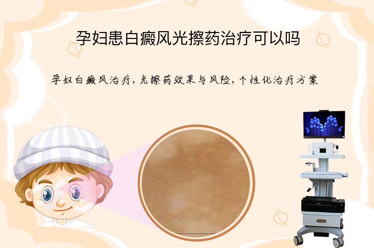 https://www.bdfsjzyy.com/d/file/p/4e46e3873f73bf27ceb6702348677a3b.jpeg