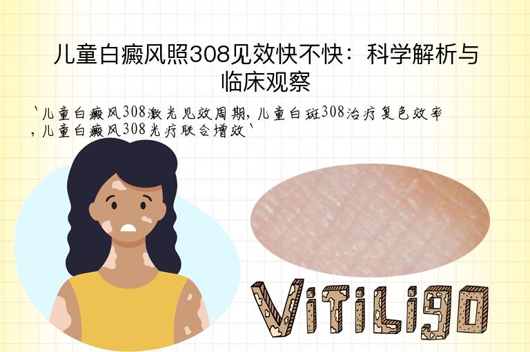 儿童白癜风照308见效快不快：科学解析与临床观察