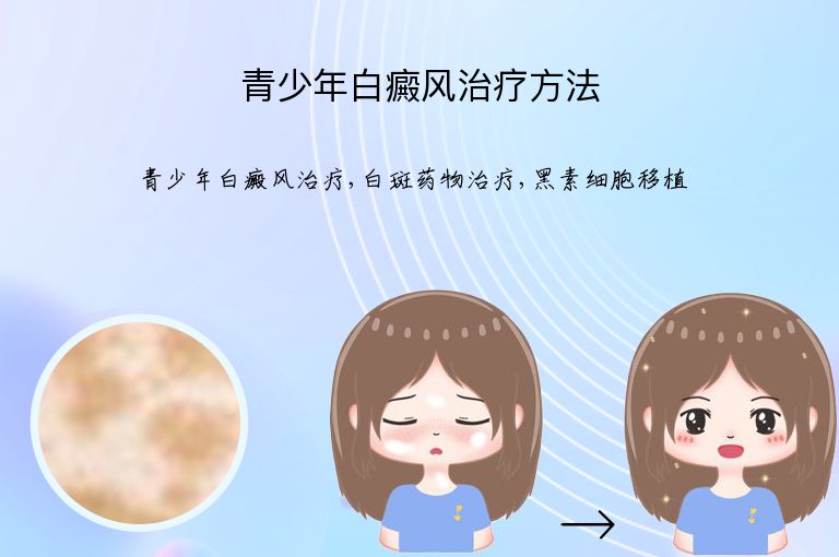 青少年白癜风治疗方法”