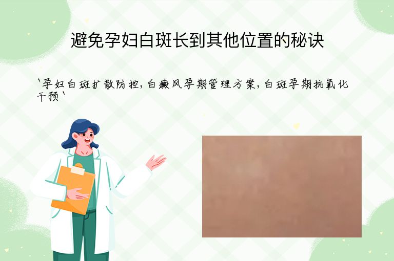 避免孕妇白斑长到其他位置的秘诀