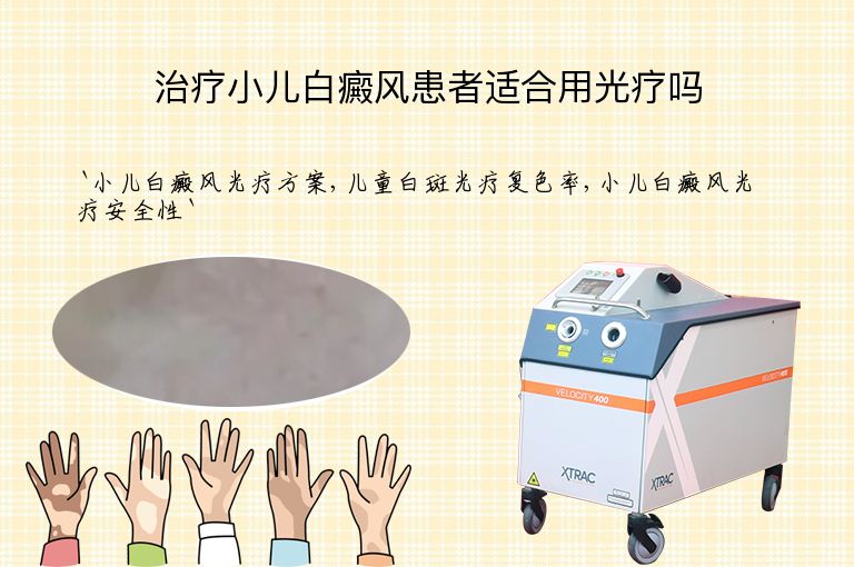 治疗小儿白癜风患者适合用光疗吗