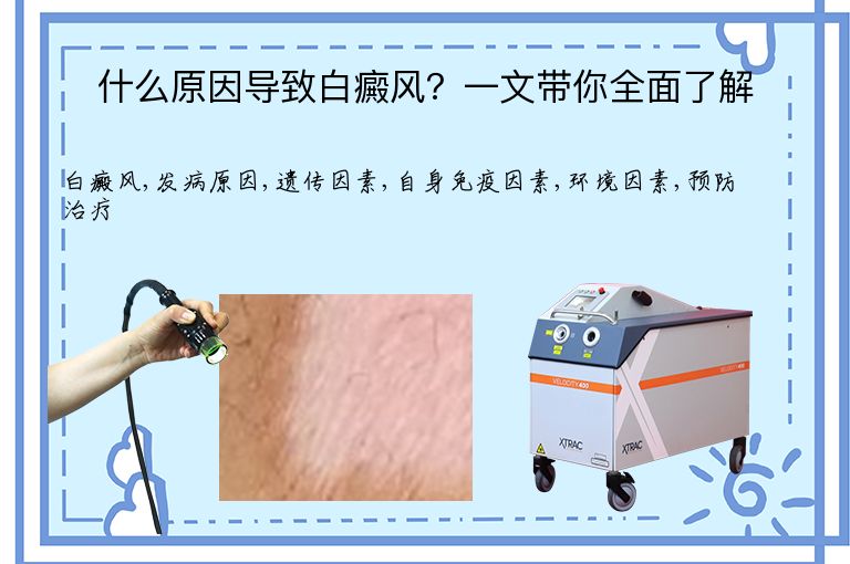 什么原因导致白癜风?一文带你全面了解”
