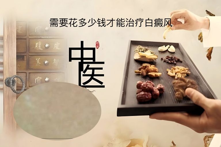 需要花多少钱才能治疗白癜风”