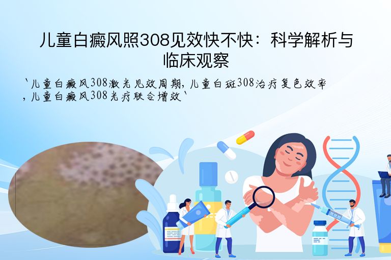 儿童白癜风照308见效快不快:科学解析与临床观察