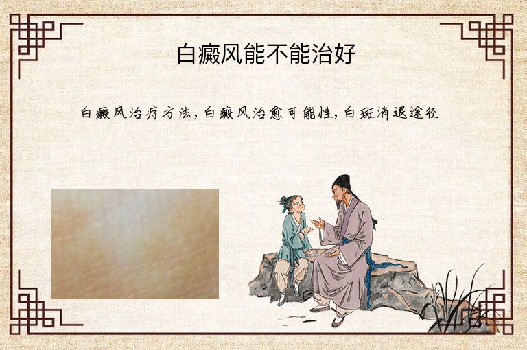 白癜风能不能治好”