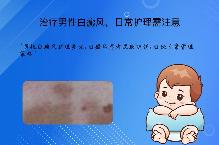 治疗男性白癜风，日常护理需注意