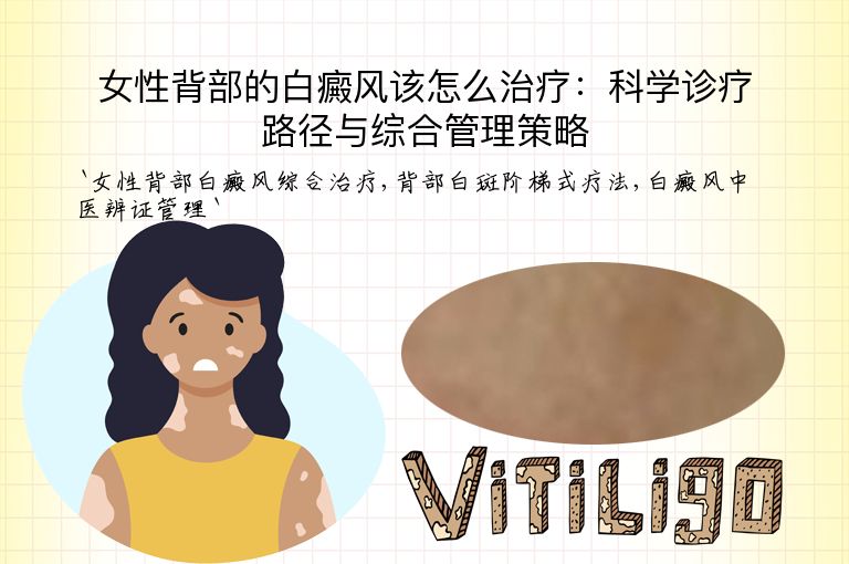 女性背部的白癜风该怎么治疗:科学诊疗路径与综合管理策略