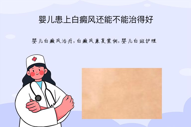 婴儿患上白癜风还能不能治得好”