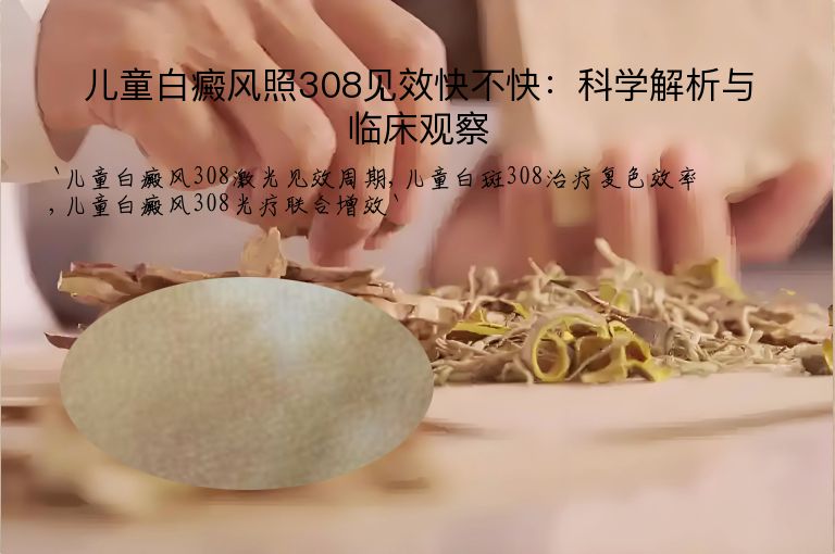 儿童白癜风照308见效快不快：科学解析与临床观察